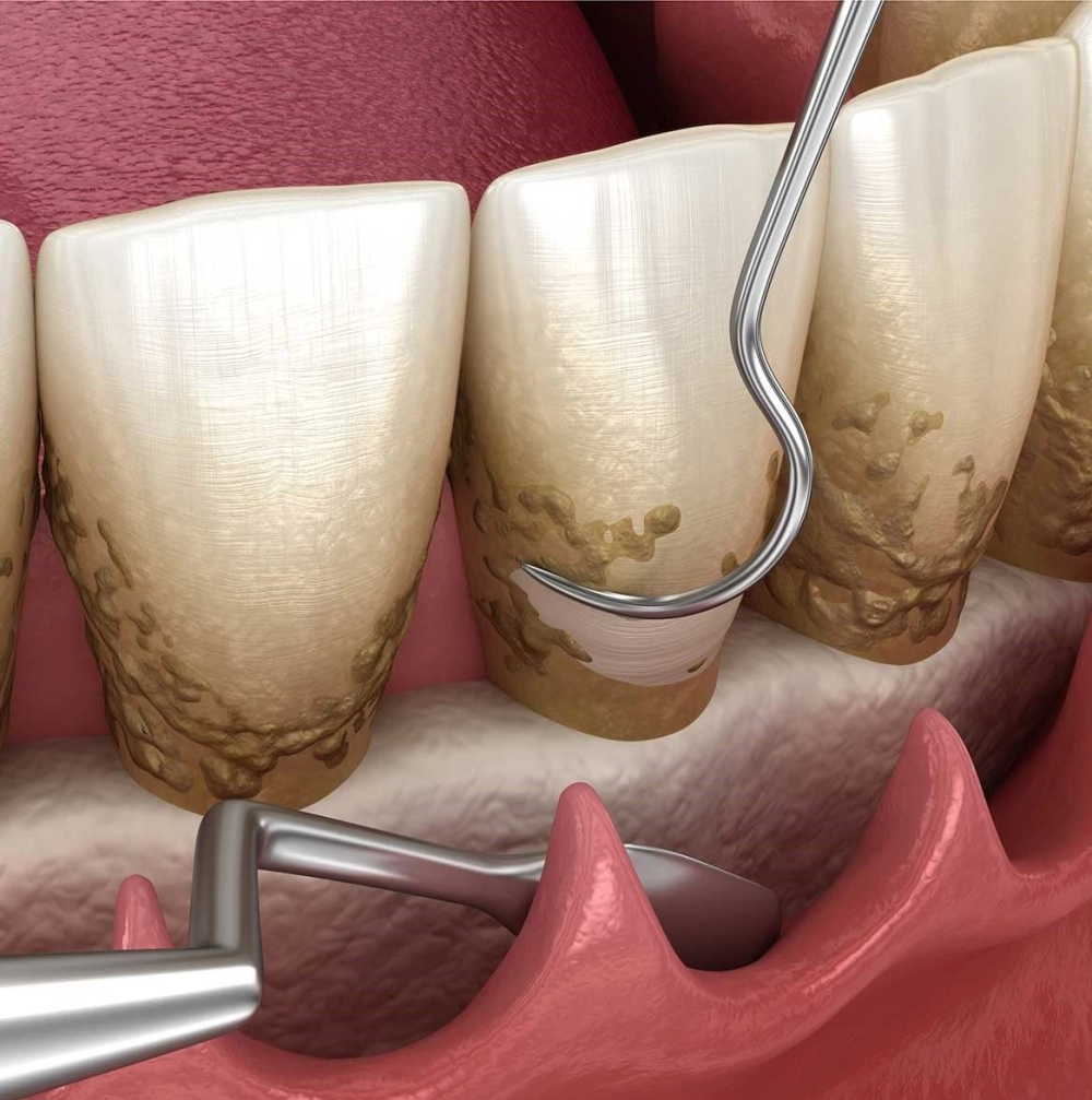 General Dental Services